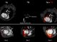 imaging and spectroscopy