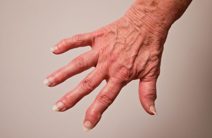 Psoriasis and Rheumatoid Arthritis, cannabinoids