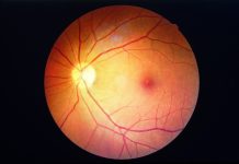 blindness from diabetic retinopathy