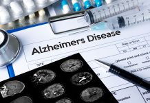 Alzheimer’s disease progression