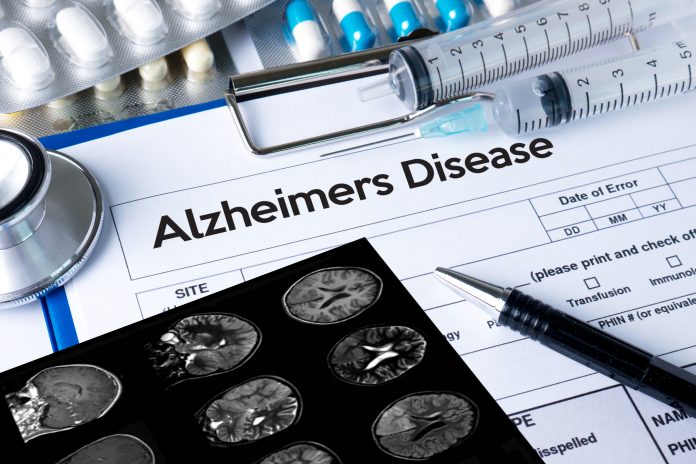 Alzheimer’s disease progression