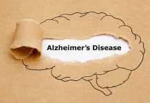 alzheimer’s disease