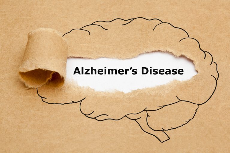 alzheimer’s disease