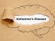 alzheimer’s disease