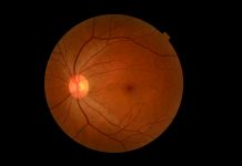 diabetic retinal screening