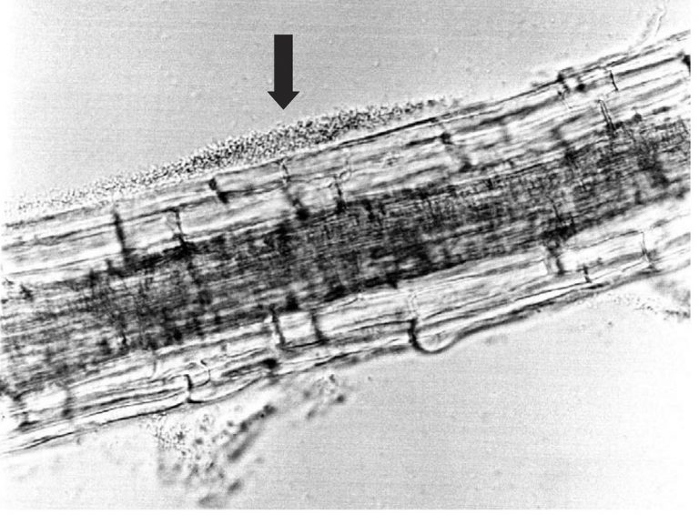 Diarrheal disease