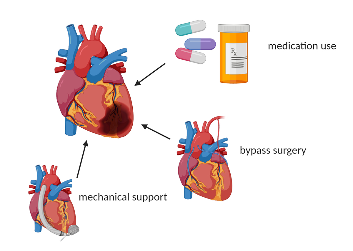 treatments for heart failure,