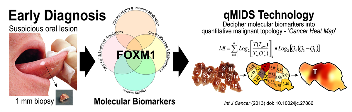 cancer detection, OPMD