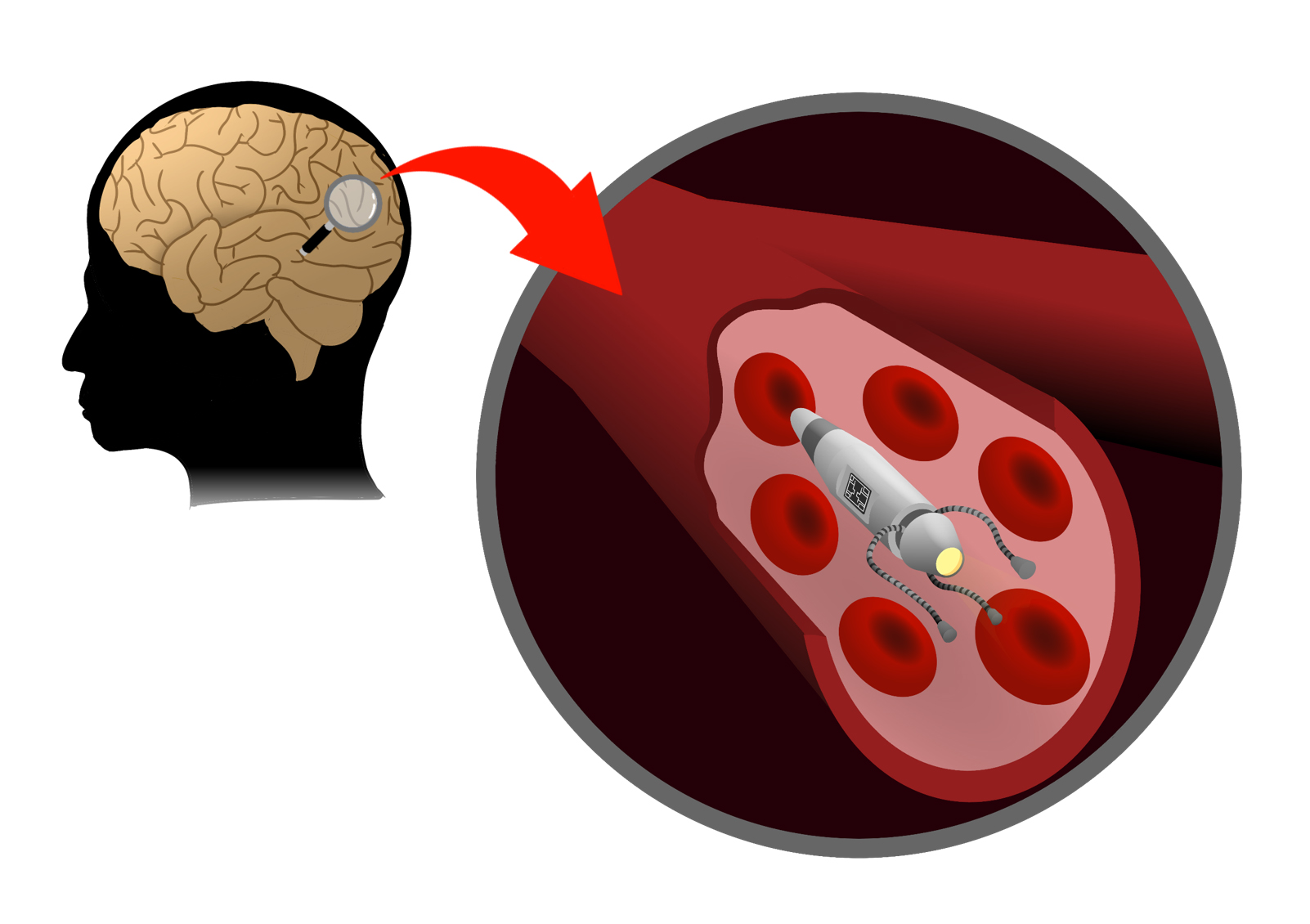 artificial brain