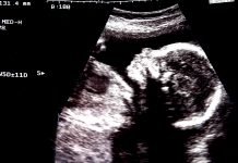 an unborn baby, generational trauma