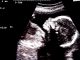 an unborn baby, generational trauma