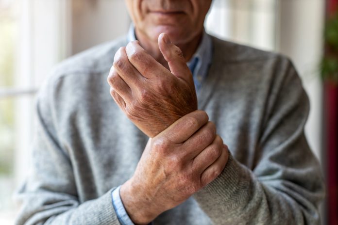 arthritis impacts