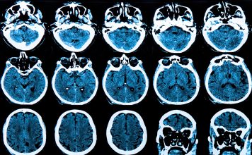 huntington's disease research, cell biology