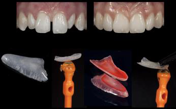 reconstructive dentistry