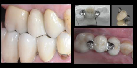 reconstructive dentistry