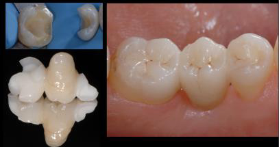 reconstructive dentistry