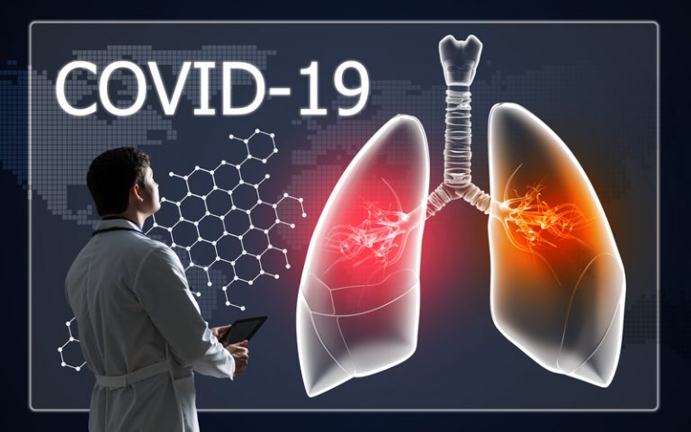 COVID-19 lung damage