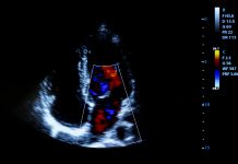 cardiac deaths during pandemic, ethnic minority