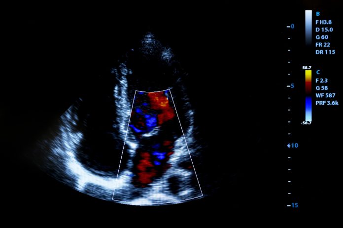 cardiac deaths during pandemic, ethnic minority