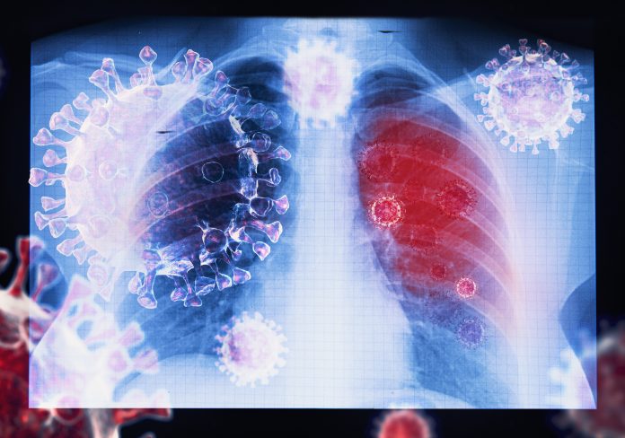 lung changes