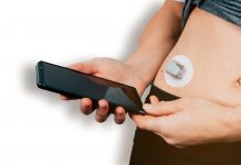 non-invasive CGM