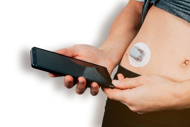 non-invasive CGM