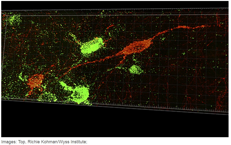 brain tissue, neuron