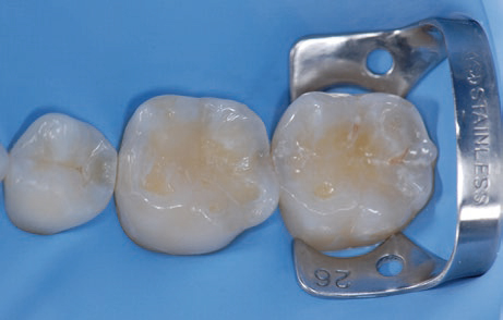 reconstructive dentistry 