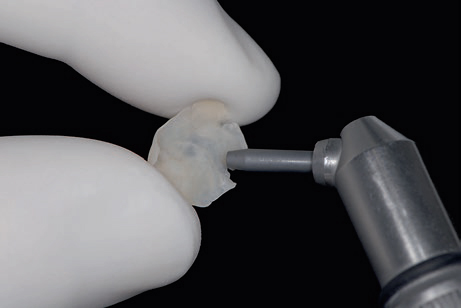 reconstructive dentistry 