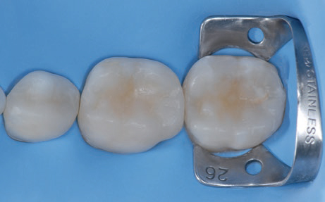 reconstructive dentistry 