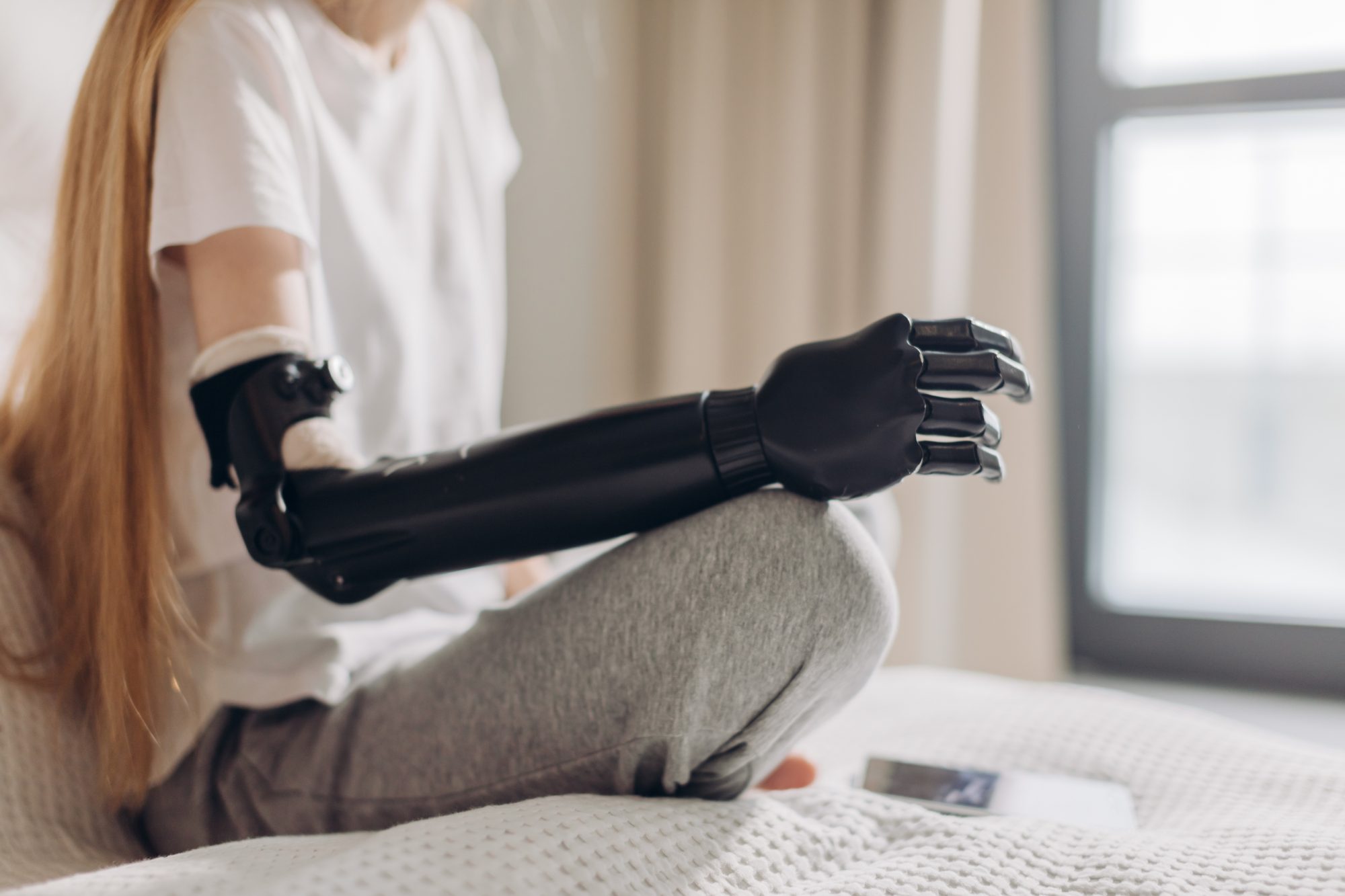 Open Bionics opens first UK clinic for amputees