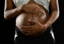childbirth black women uk, MBRRACE-UK