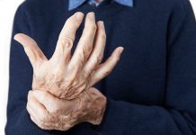 cbd for arthritis