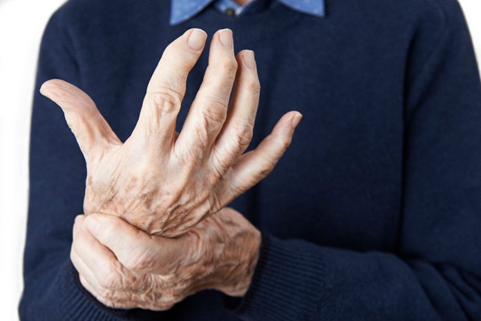 cbd for arthritis