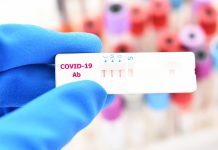 COVID-19 antibody response