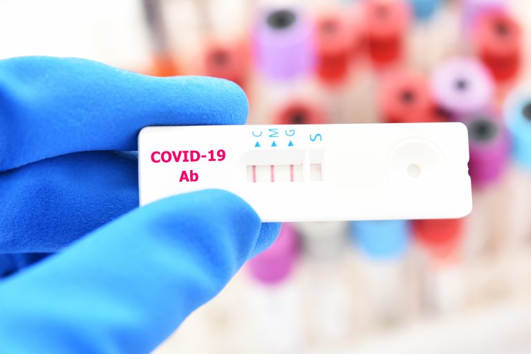 COVID-19 antibody response