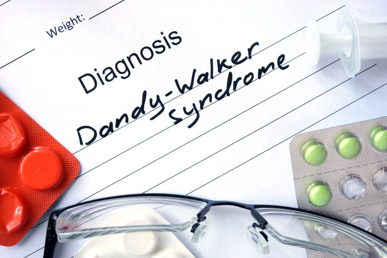 Dandy-Walker Syndrome