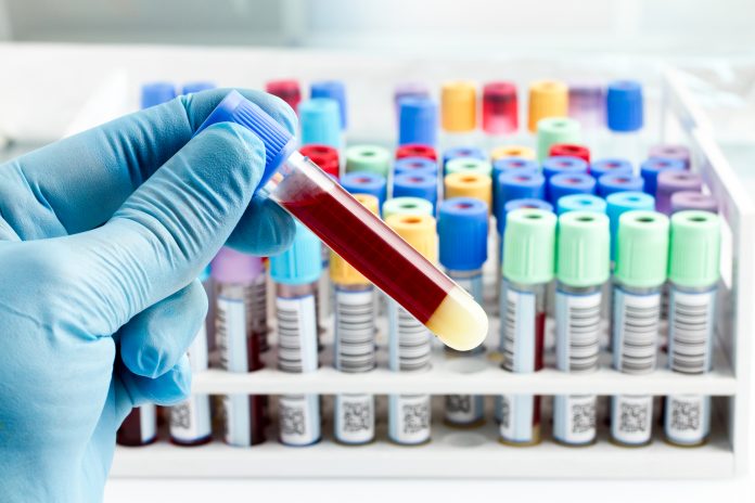 cancer diagnostics