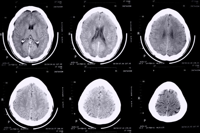 dark genome, mental disorders