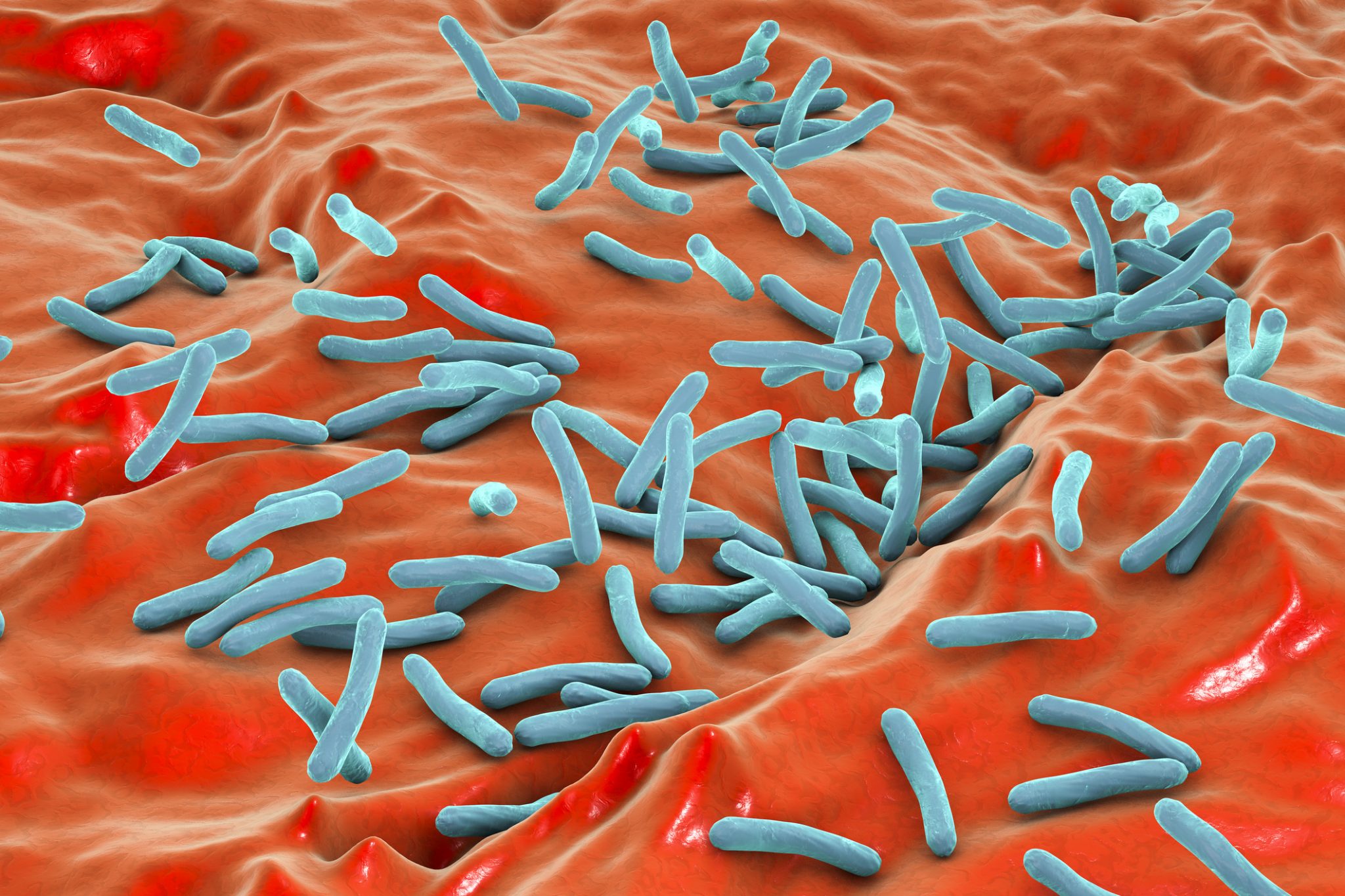 Treating multi drug resistant tuberculosis