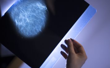 AI tools for mammography
