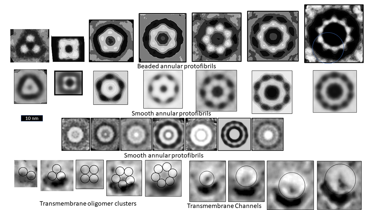 Amyloids, membrane channels structures 