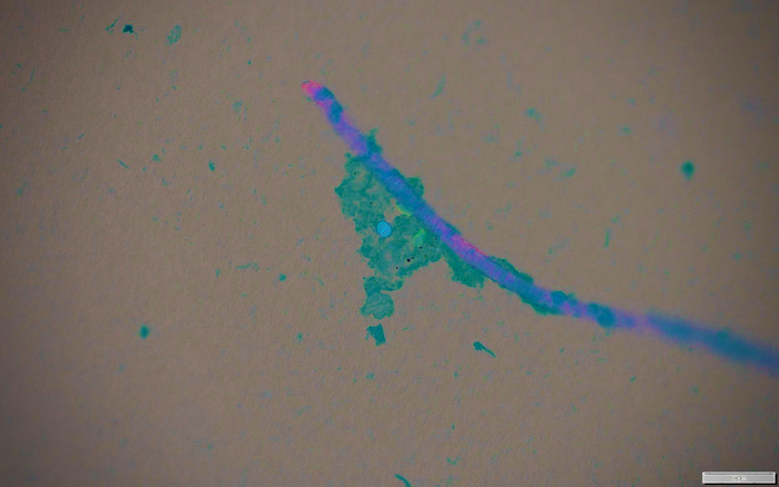 Microplastics carrying pathogens