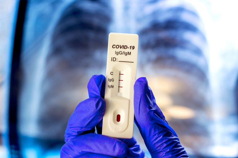 inflammation from covid-19, antibodies