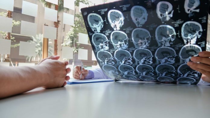 outcomes for stroke patients, AI