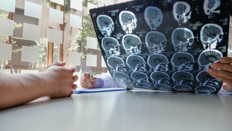 outcomes for stroke patients, AI