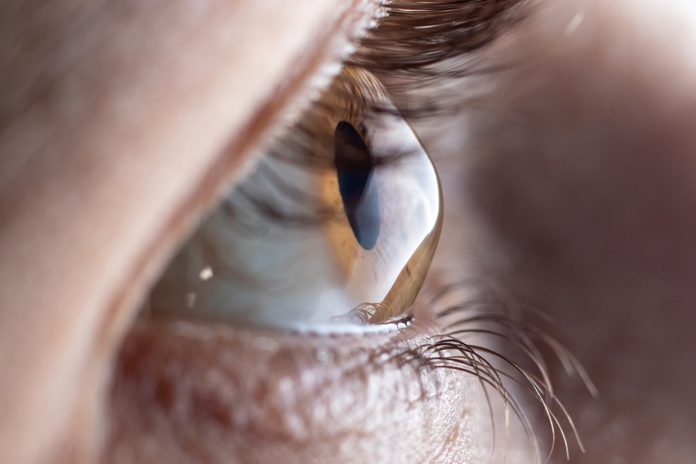 data, degenerative eye disease
