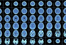 effects of nanoparticles