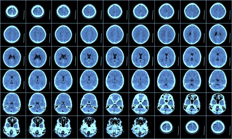 effects of nanoparticles