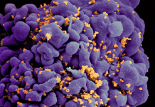 Scanning electron micrograph of an HIV-infected H9 T cell